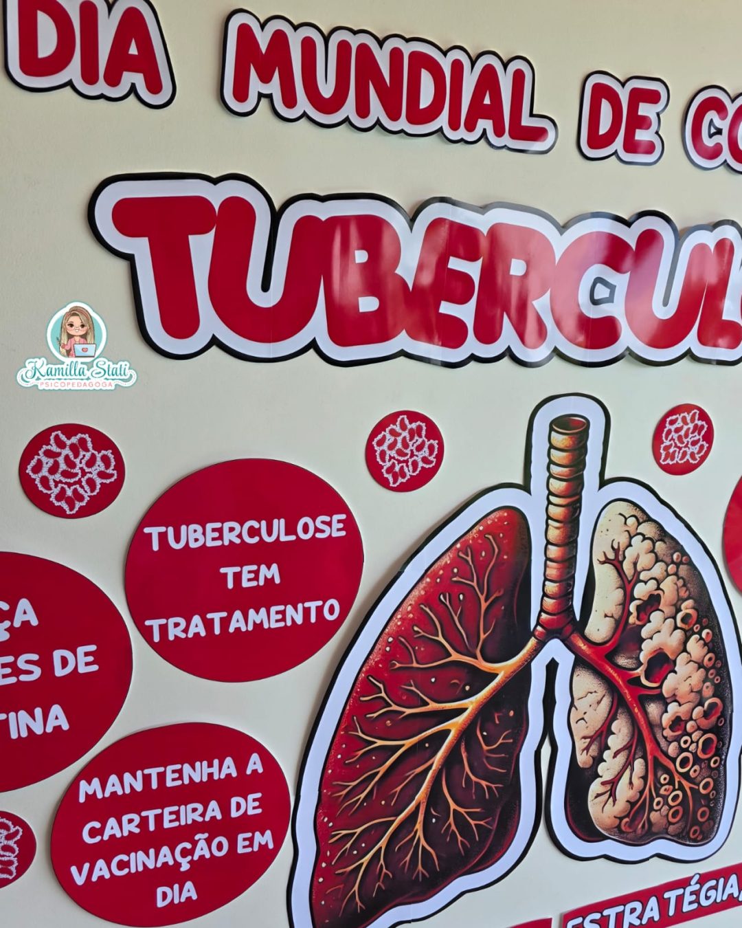 Painel dia mundial de combate à tuberculose - Imagem 5