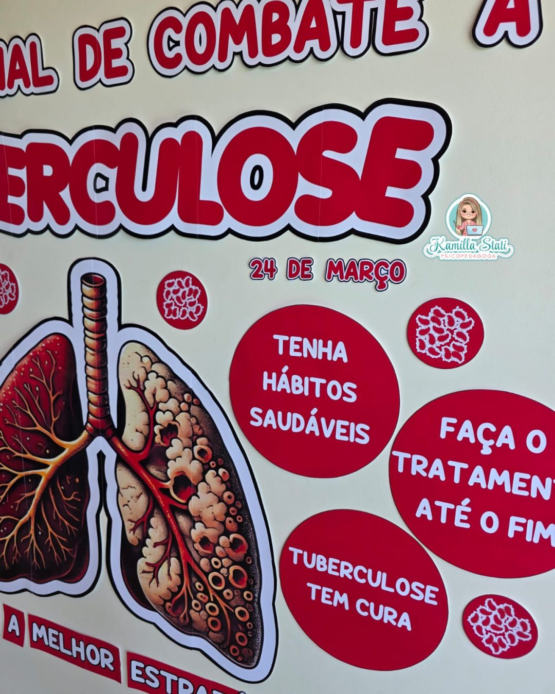 Painel dia mundial de combate à tuberculose - Imagem 6